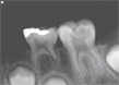 insight20_2
